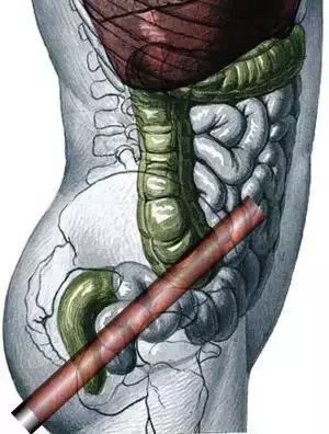 凯利帮的真实历史